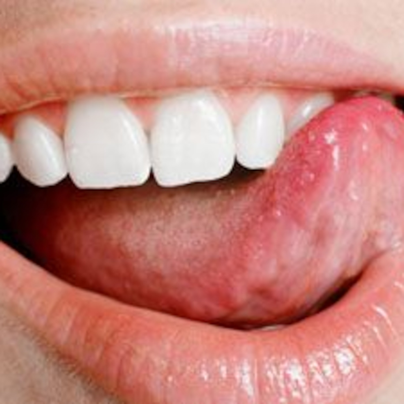Как правильно делать аппаратный маникюр нужными фрезами Как отучить ребенка грызть ногти на руках советы психолога