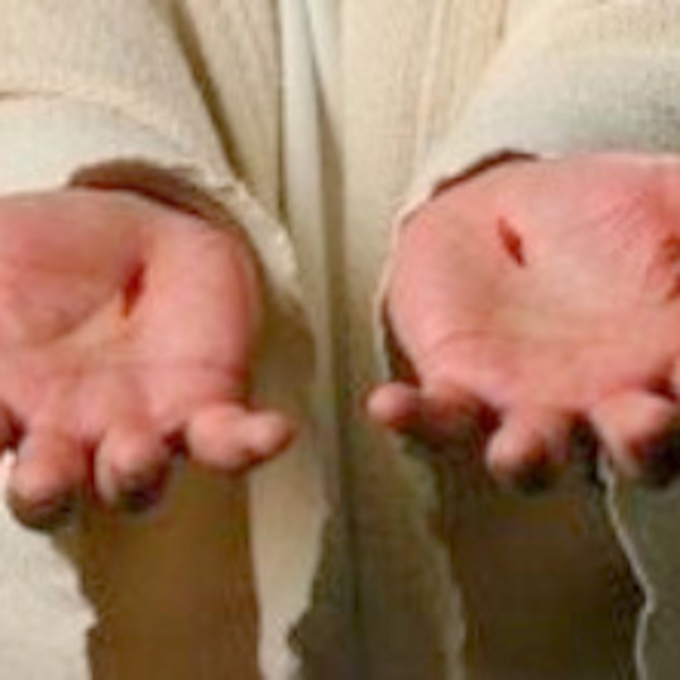 THE SCARS ON OUR SOUL