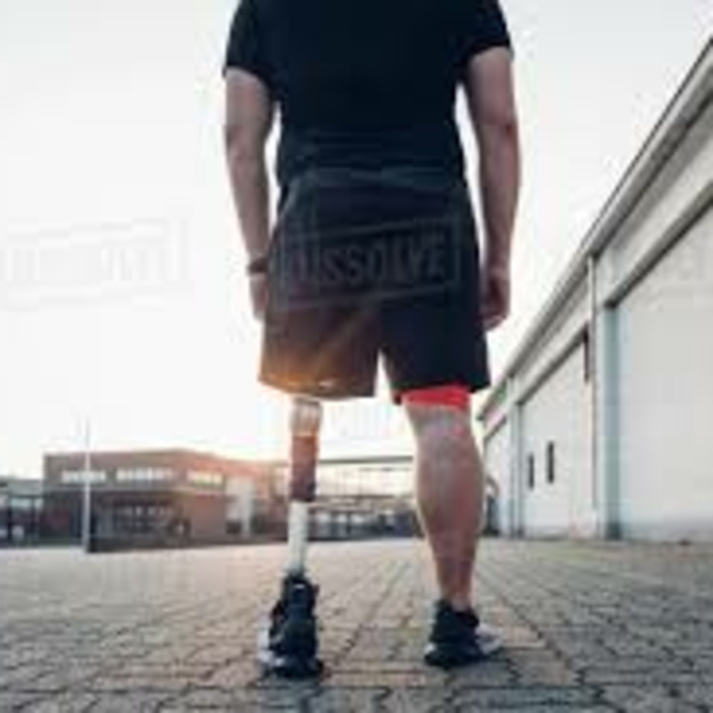 All about Prosthetics