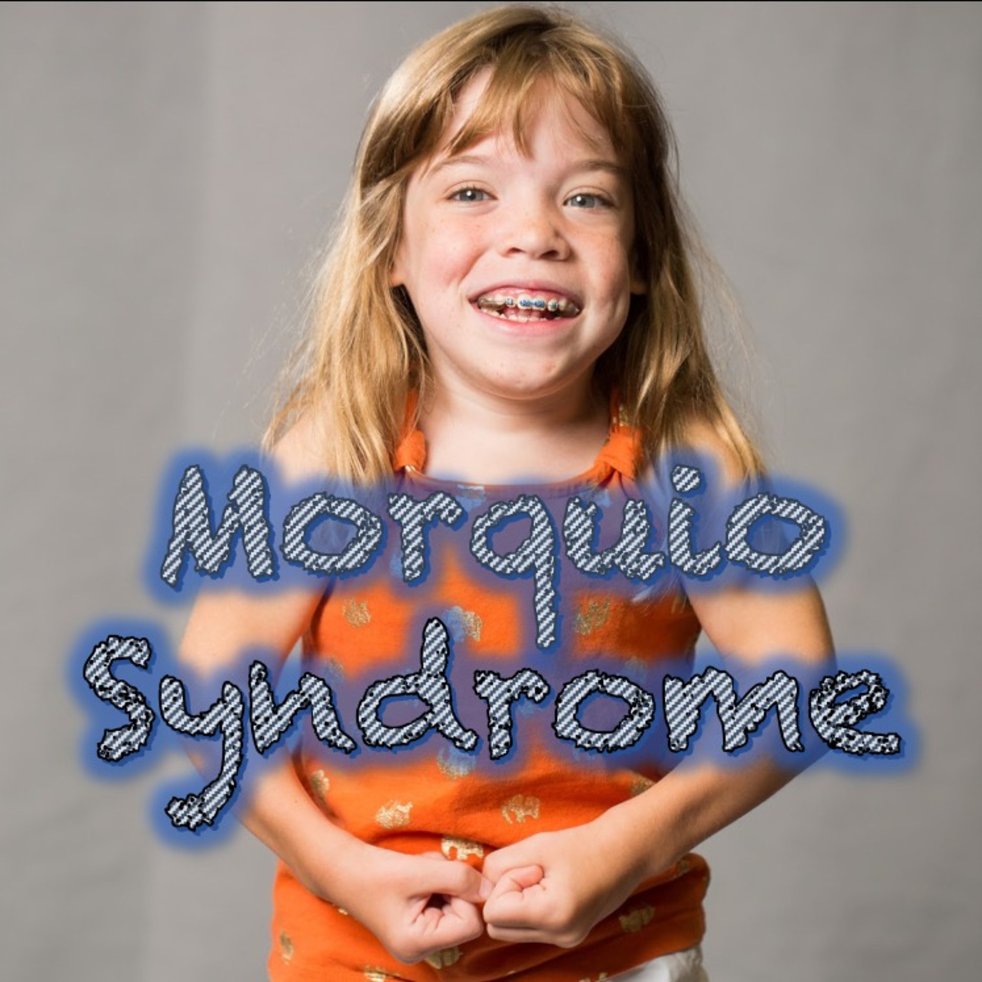 Morquio Syndrome