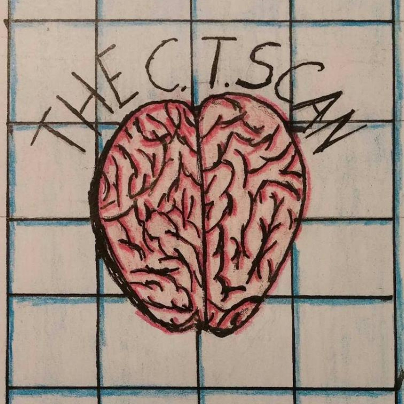 The Solo CT Scan