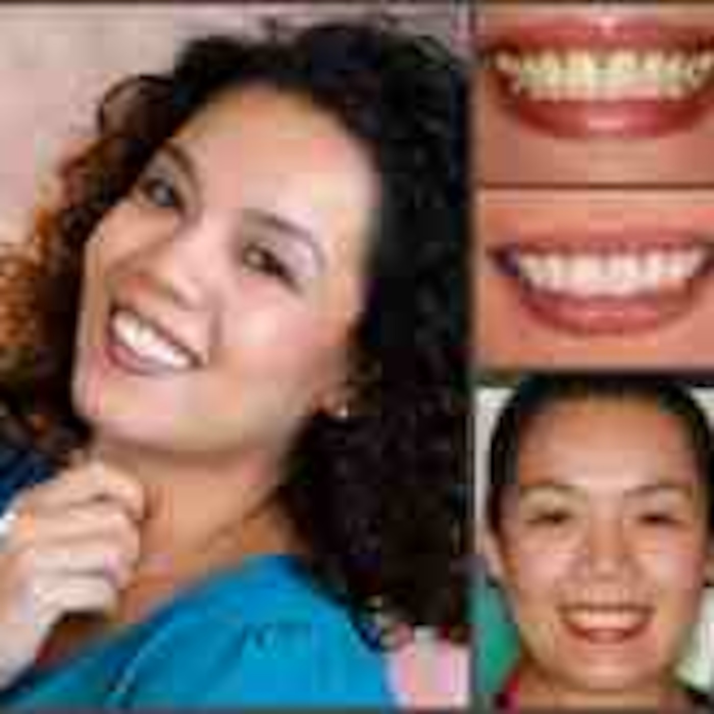 Conditions That Can Be Treated With Cosmetic Dentistry