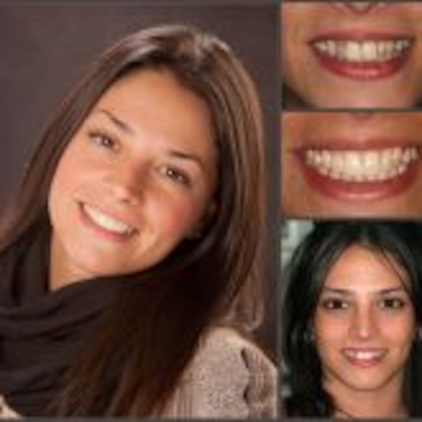 Get The Smile That You Wanted To Have