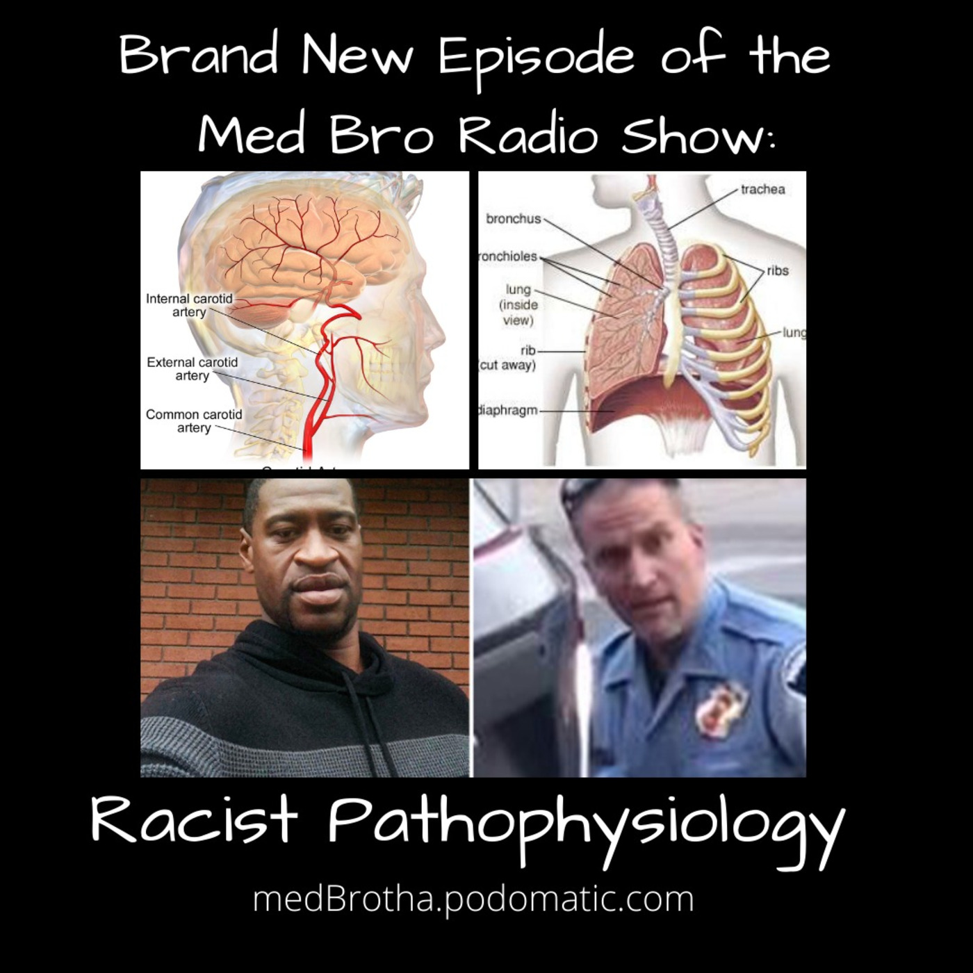 Racist Pathophysiology