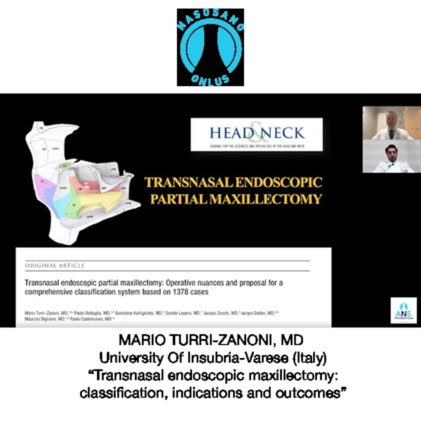Transnasal endoscopic maxillectomy: classification, indications and outcomes