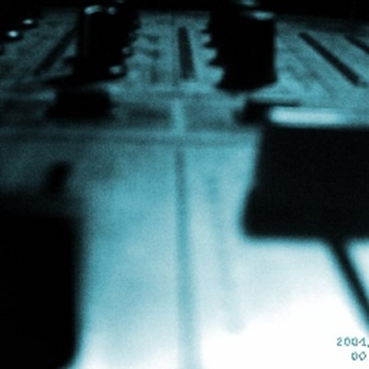 Brain Damage by NUCLEAR FX aka ANARKYA episode artwork