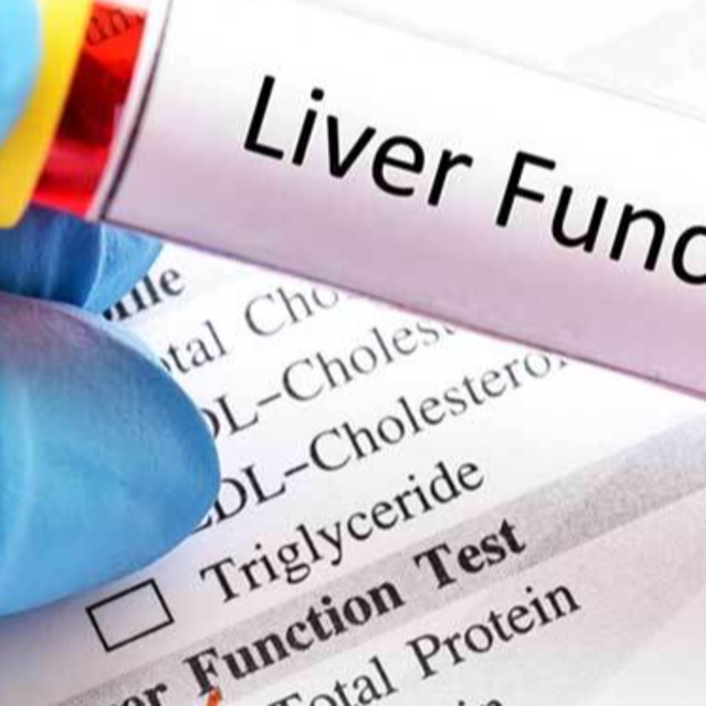 Episode 111: Liver Function Tests - Understanding Your Blood Test Results