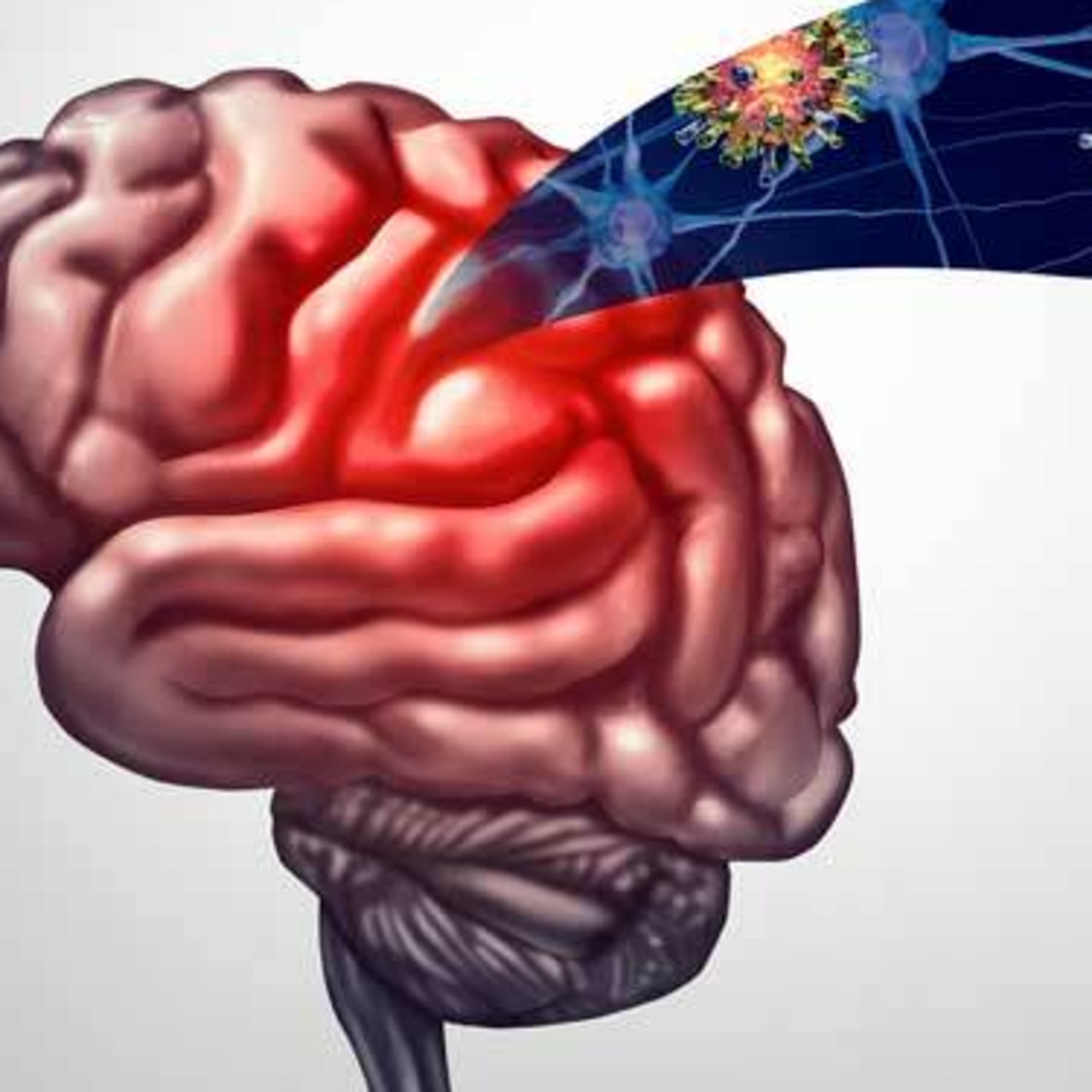 Brain inflammation - What you need to know