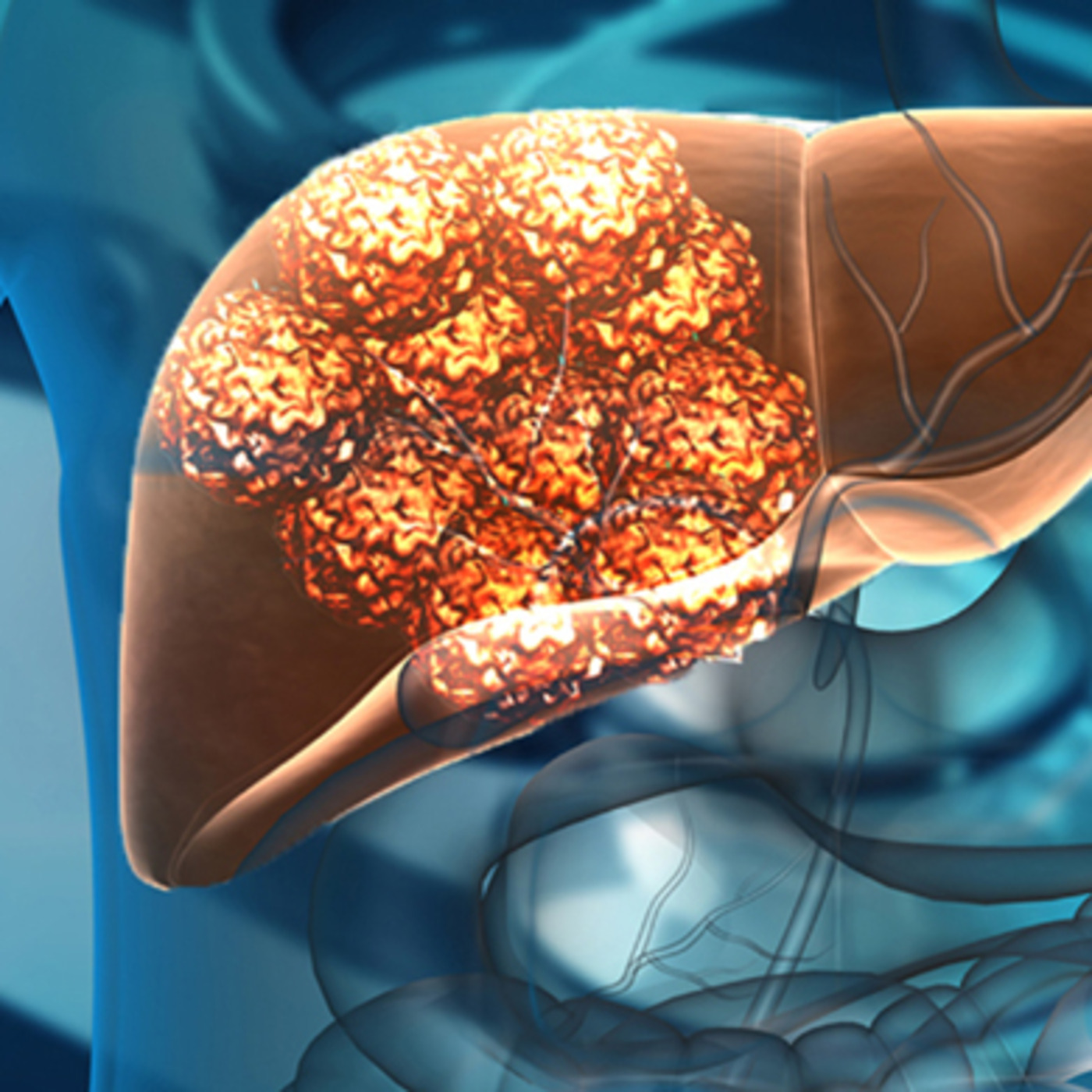 All About Your Liver- PART 4 Your Liver And Your Immune System episode artwork