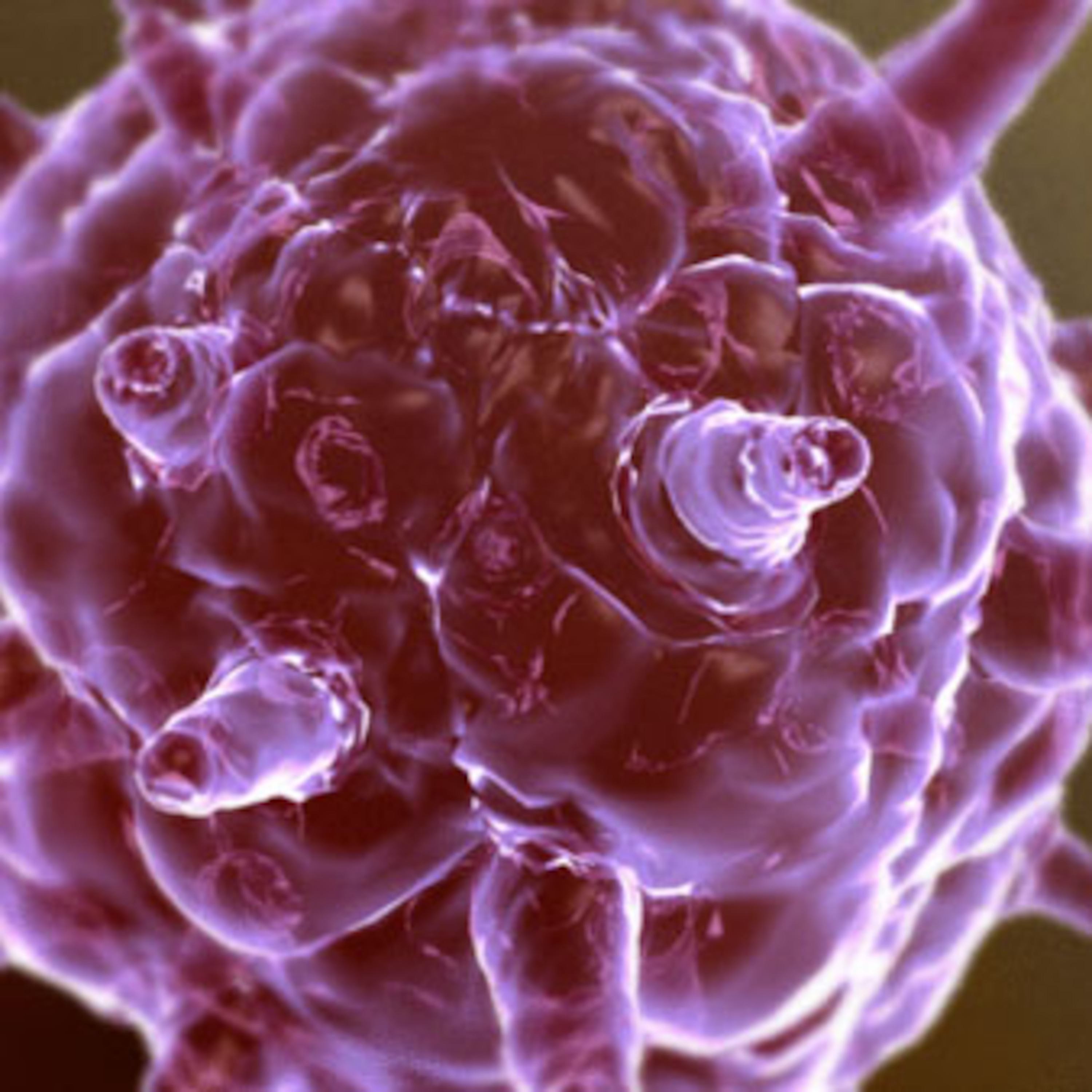 173 - Tratamento do HPV