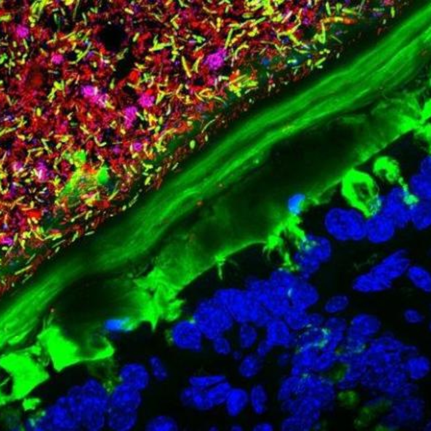 Understanding the Pathogenesis of Inflammatory Bowel Diseases, and moving towards a ”Functional Cure”: Michael Briggs, PhD