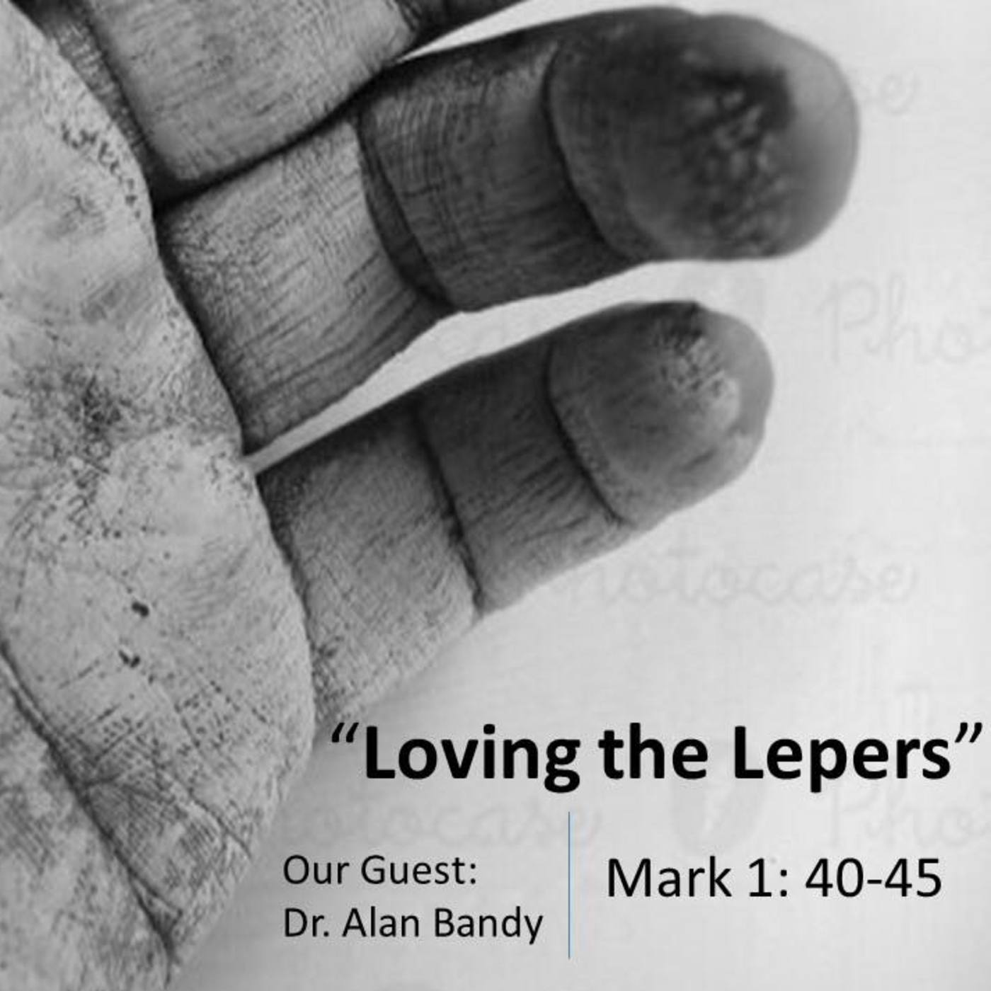 Loving the Lepers