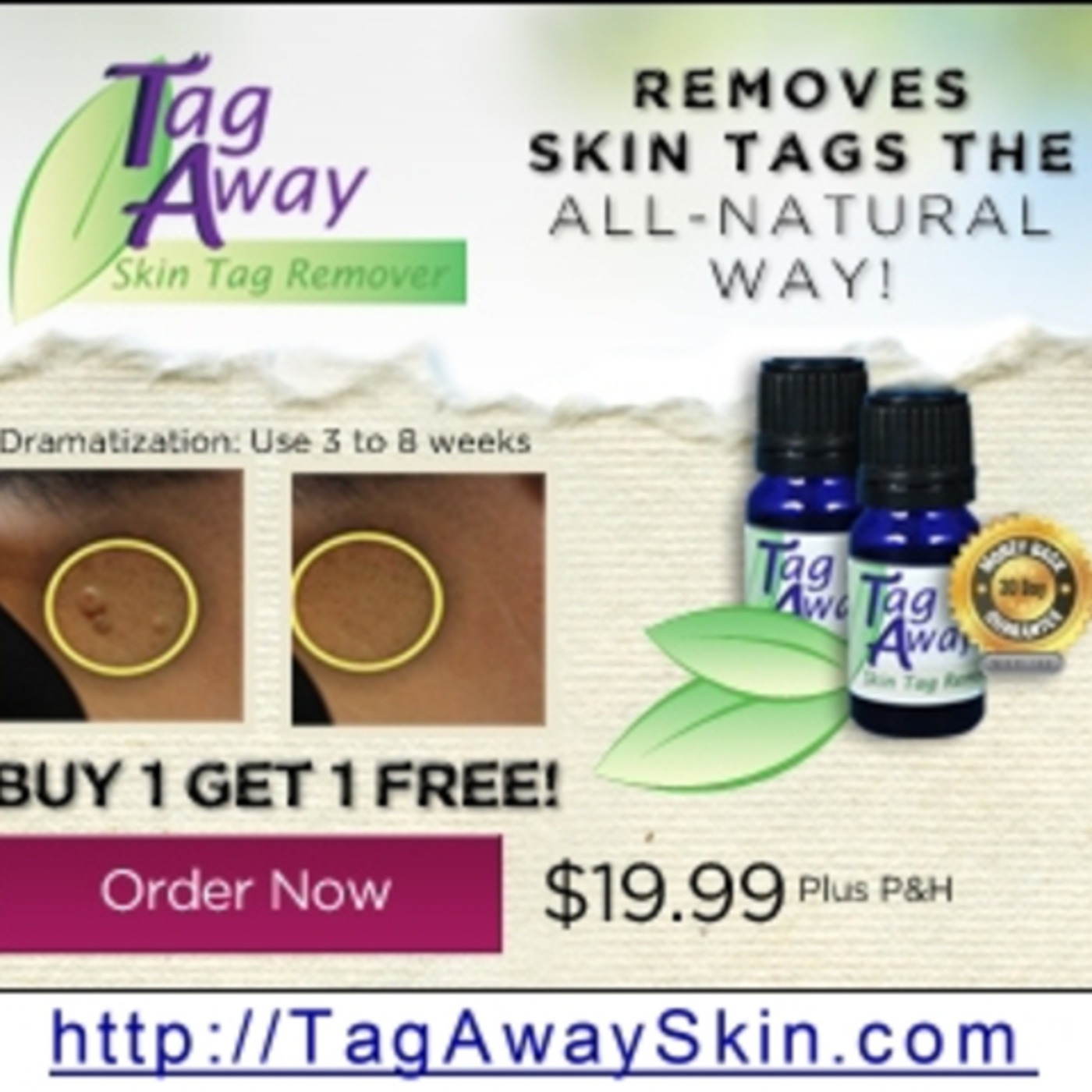 Tag Away Skin Tag Remover