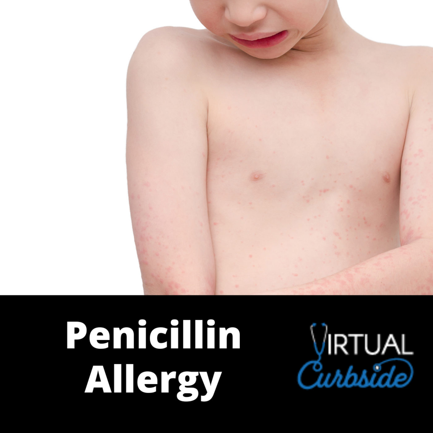 Episode 193: #45-2 Problems with Penicillin Allergy episode artwork