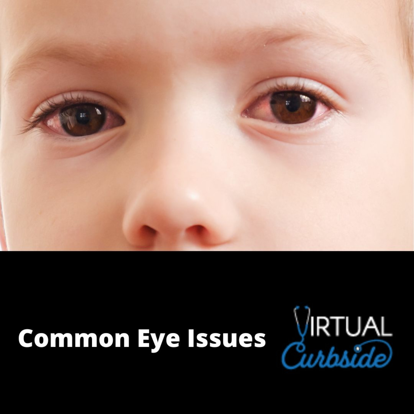Episode 367: #85-3 Common Eye Issues: Allergic Conjunctivitis