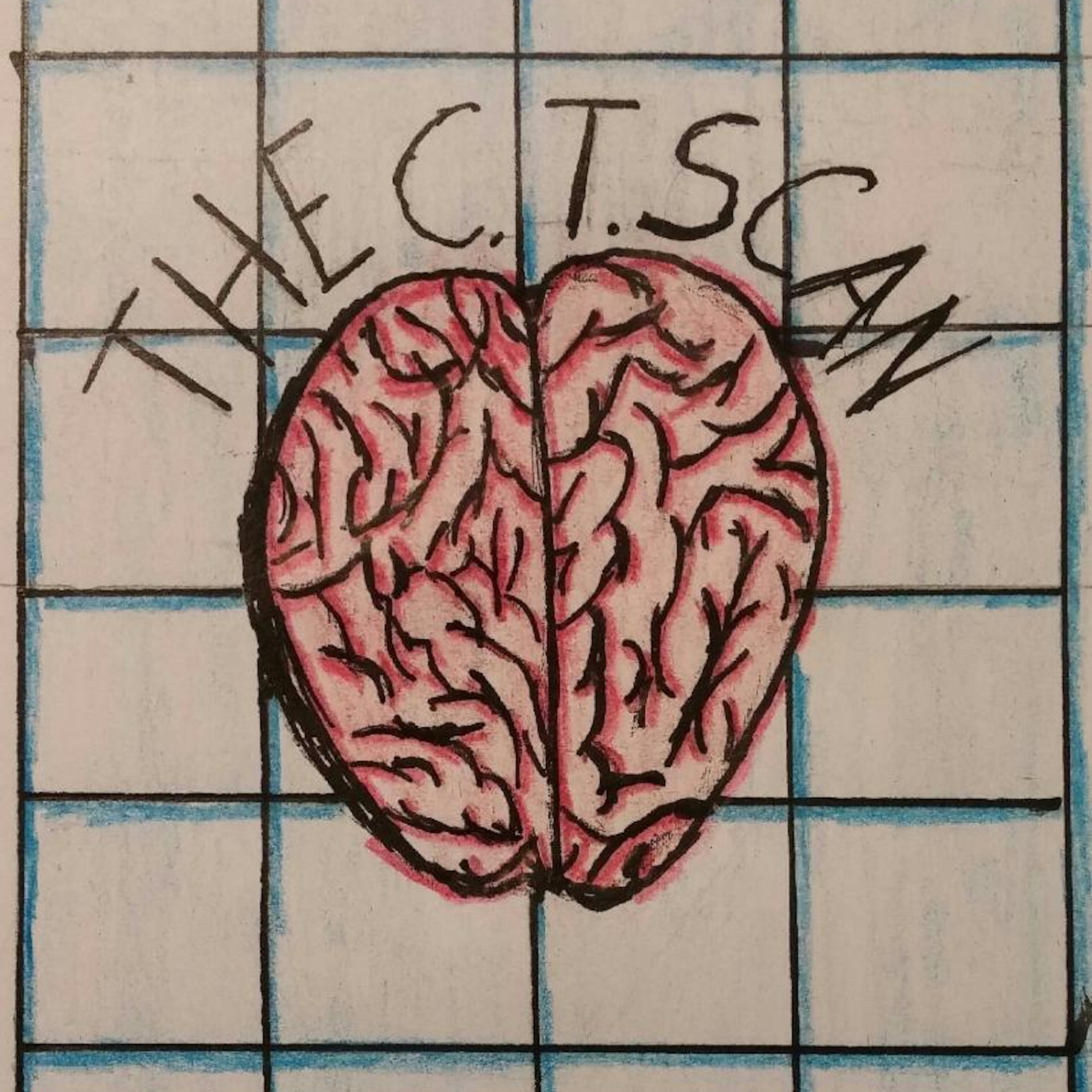 The C.T. Scan