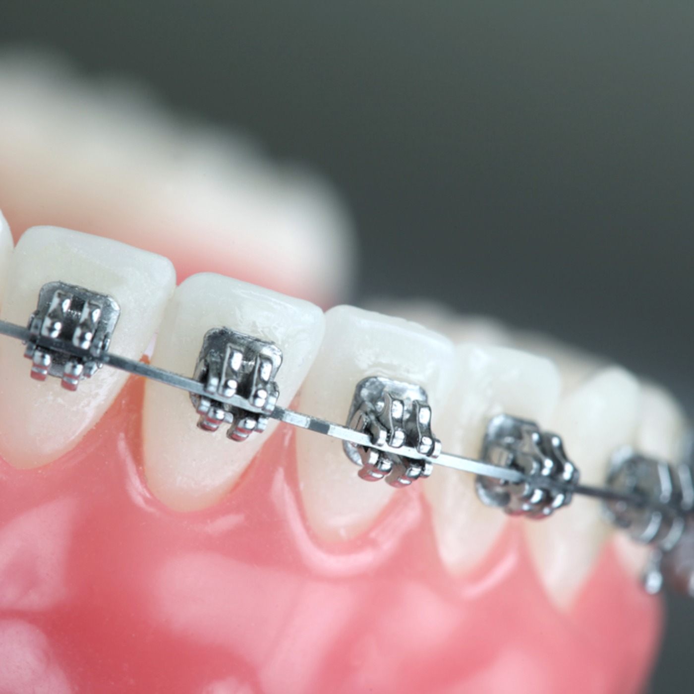 Dental Braces El Paso TX, Orthodontics El Paso TX