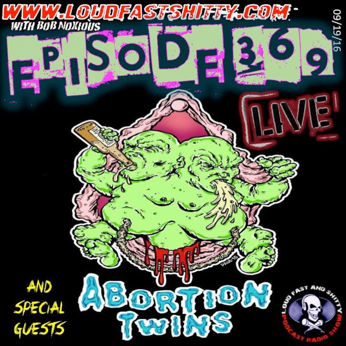 Episode 369 | Abortion Twins | September 19, 2016