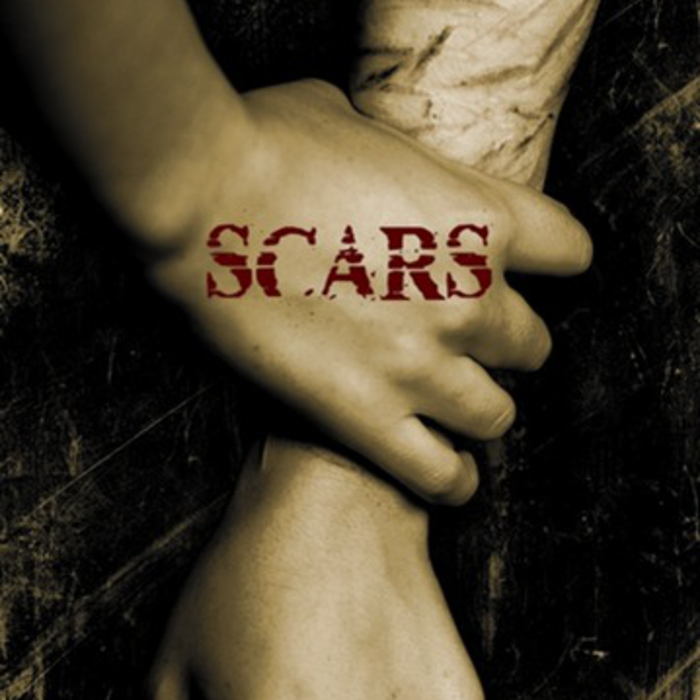 Episode 21: Scars
