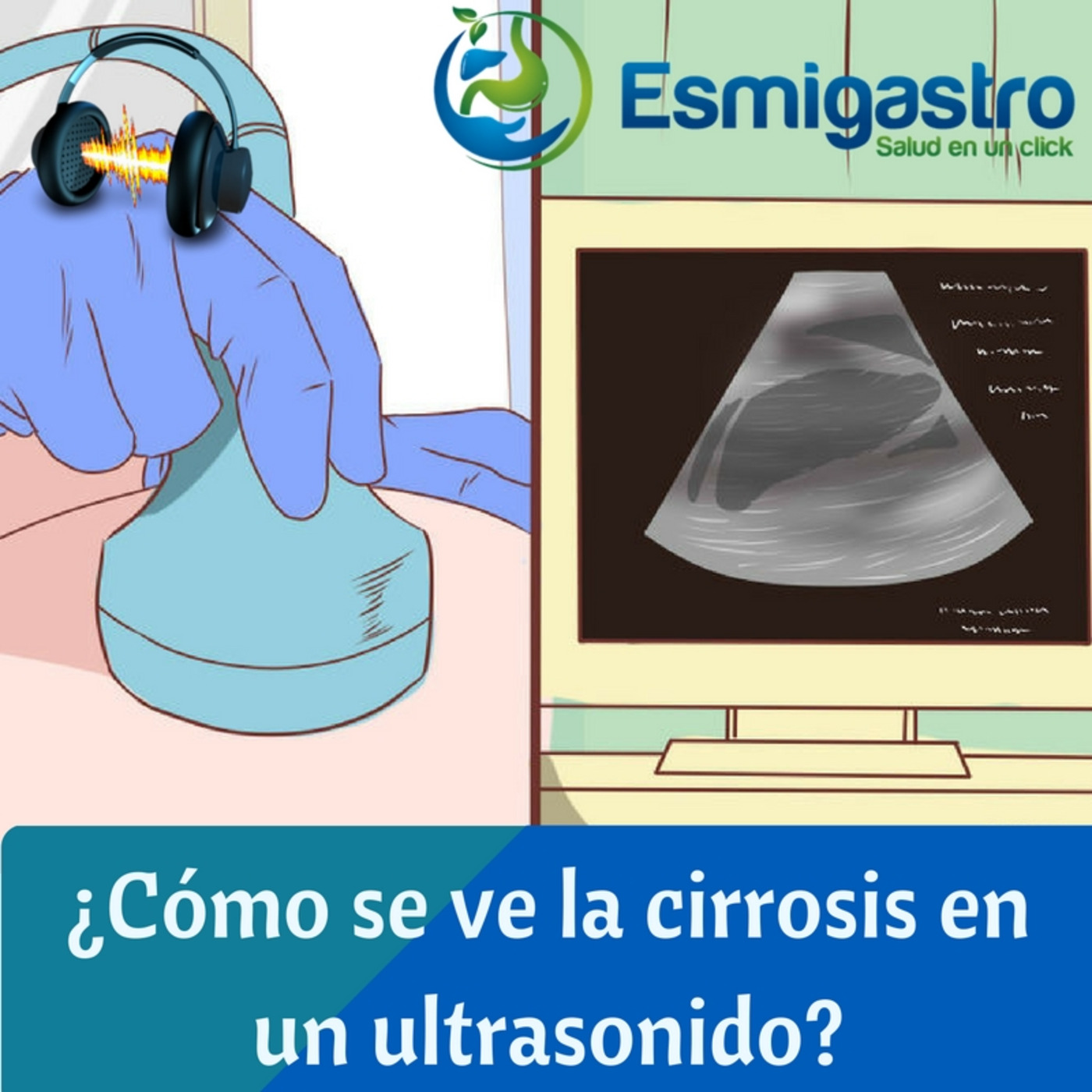 Asesoría para pacientes con enfermedades hepáticas