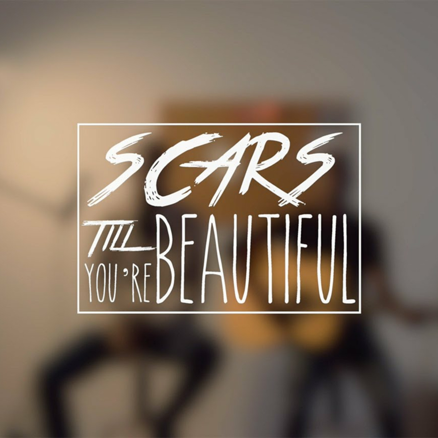 Alessia Cara- Scars to Your Beautiful (DrewG. & Brian Cua Anthem) episode artwork