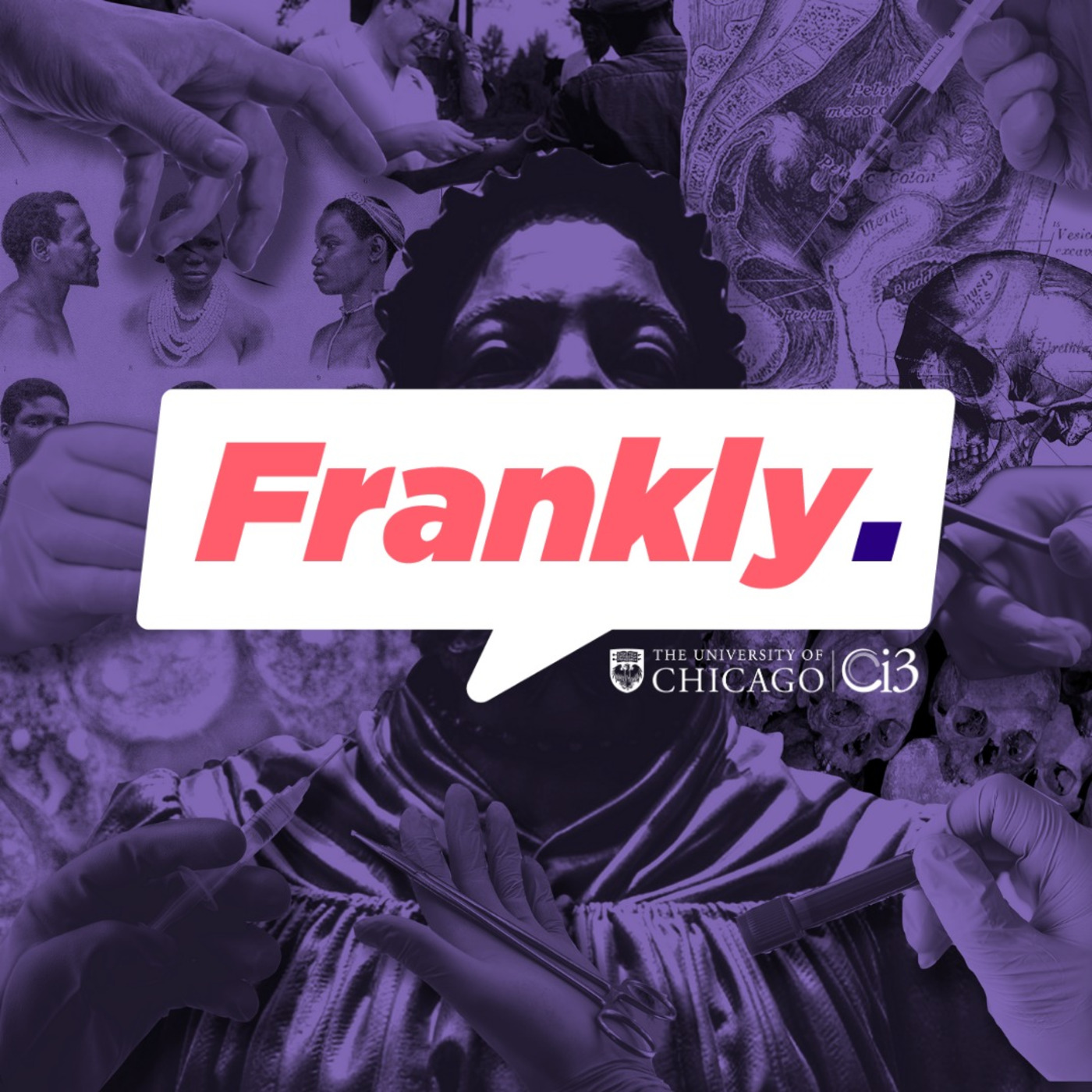 Frankly. Podcast