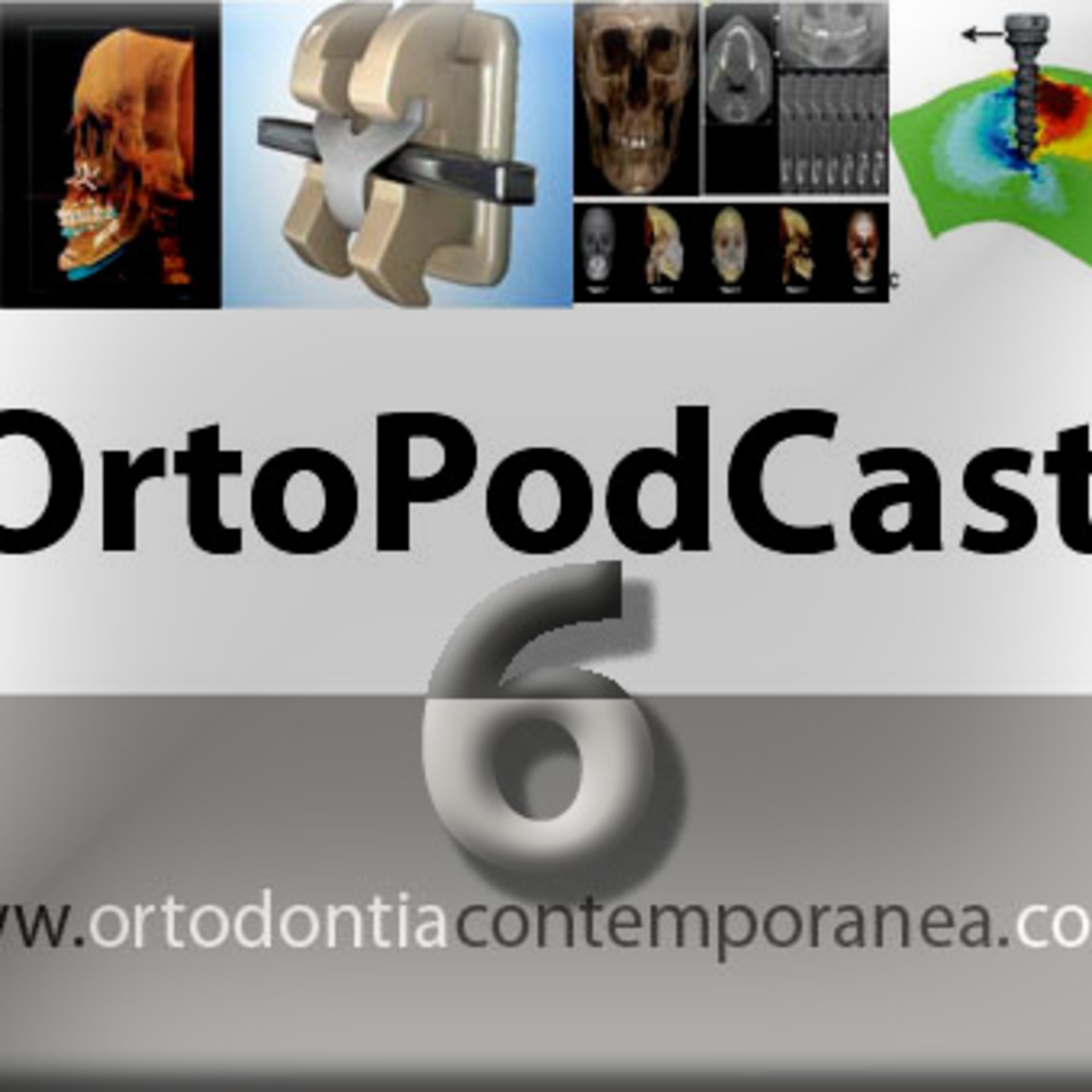 Episode 6 - Relação entre os índices de maturação das vértebras cervicais e os estágios de calcificação dentária.