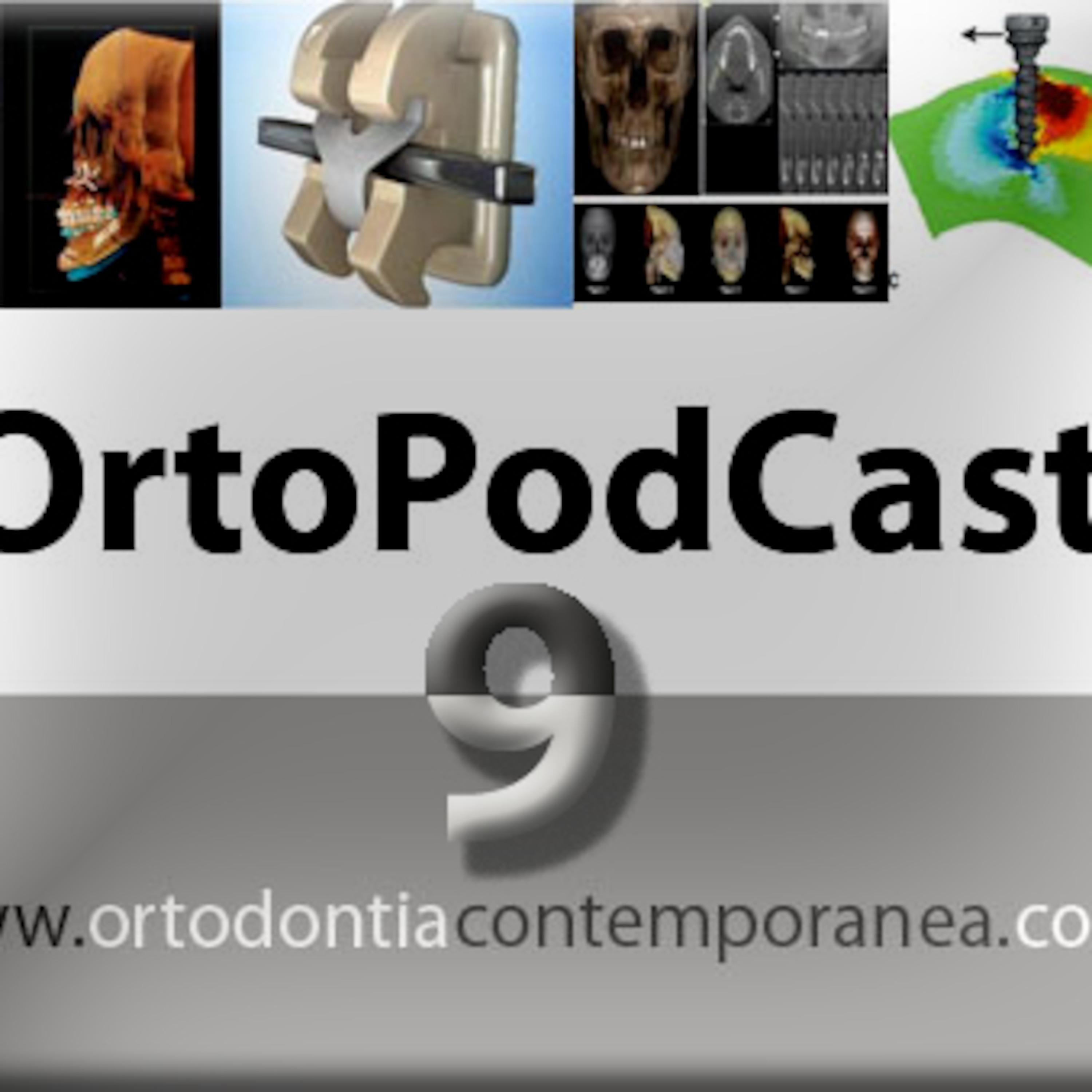 Episode 9 - Minimplantes