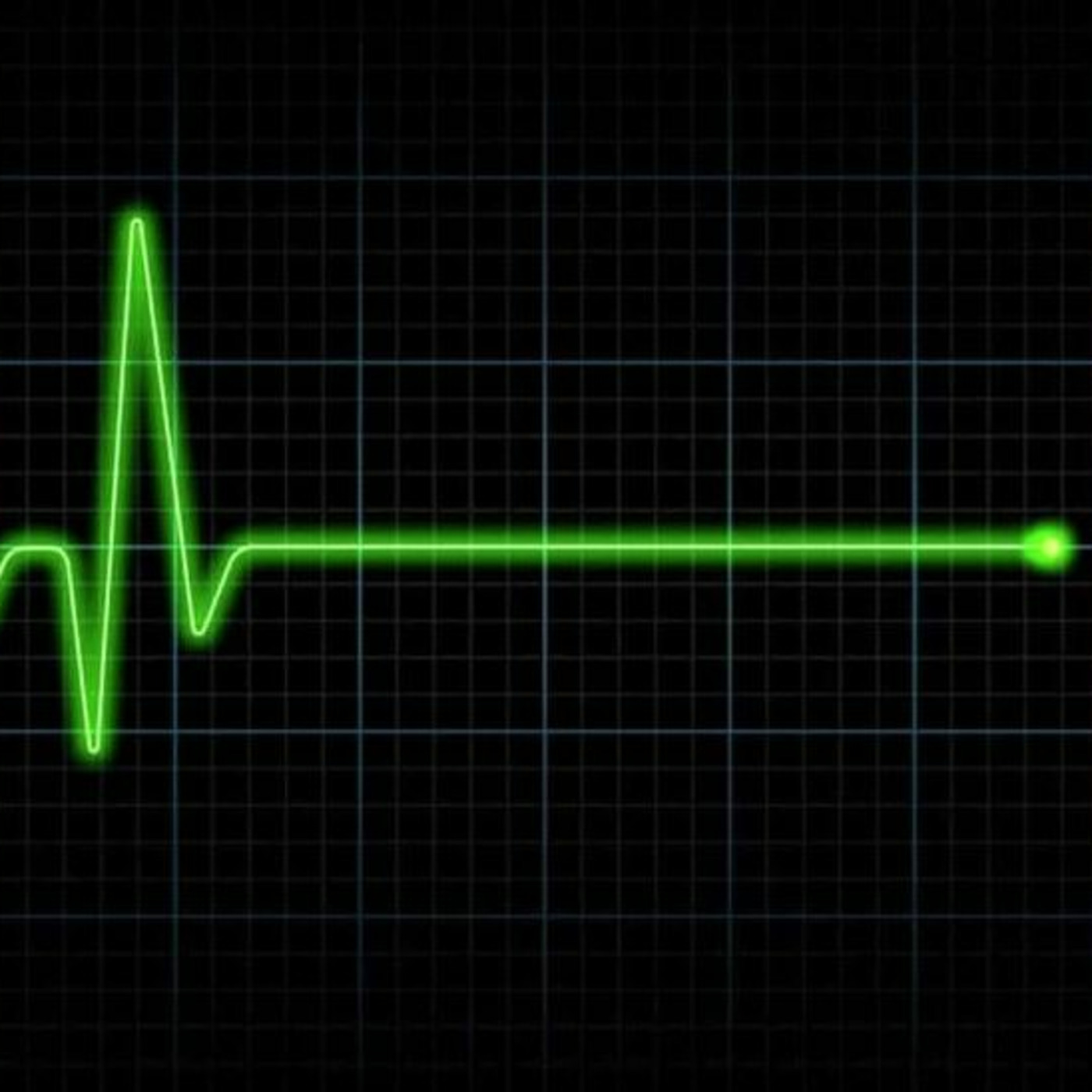 Episode 217: After That