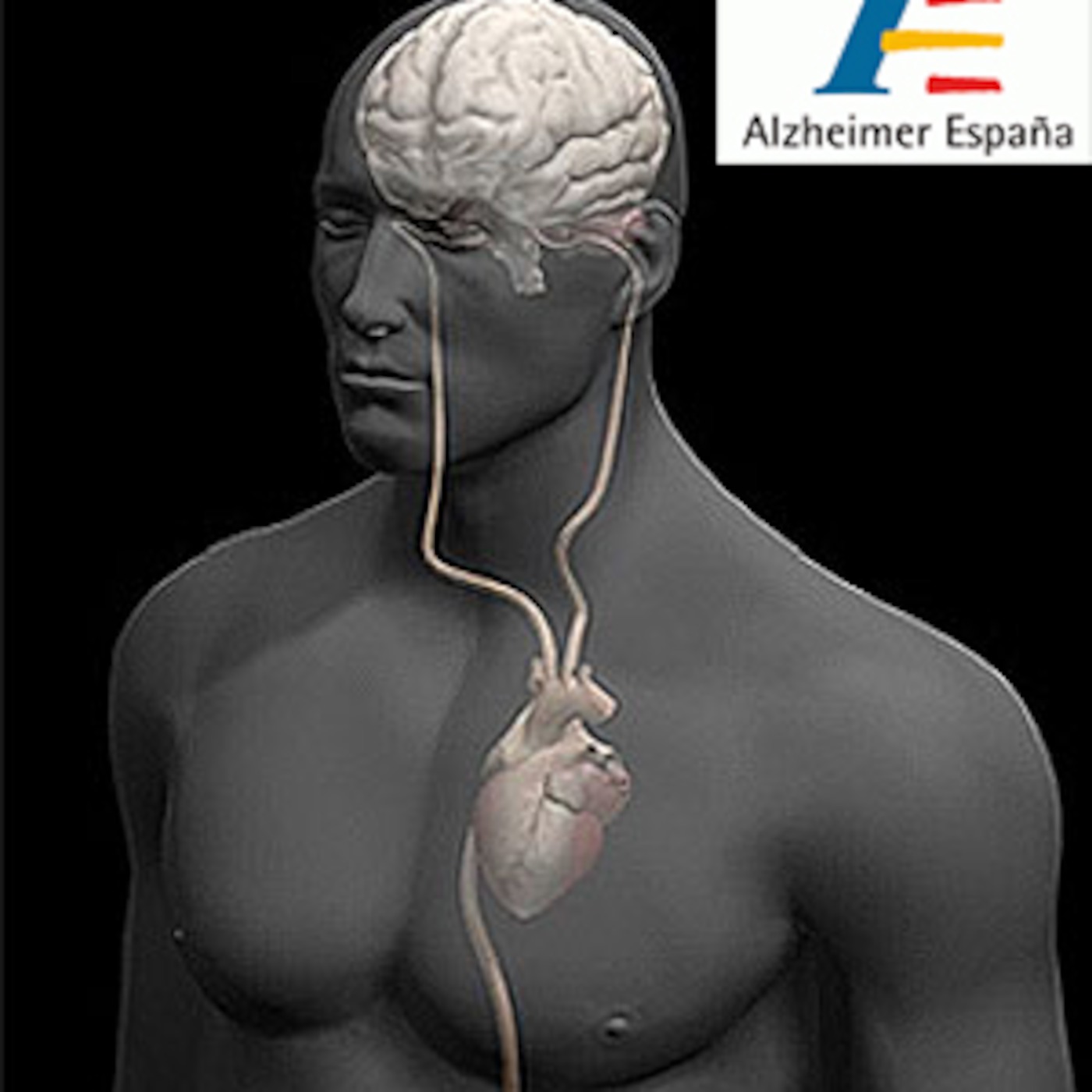 Alzheimer: diagnostico precoz y riesgo cerebral. ¿Cuál es la diferencia? - El Rincón de Aloysa episode artwork