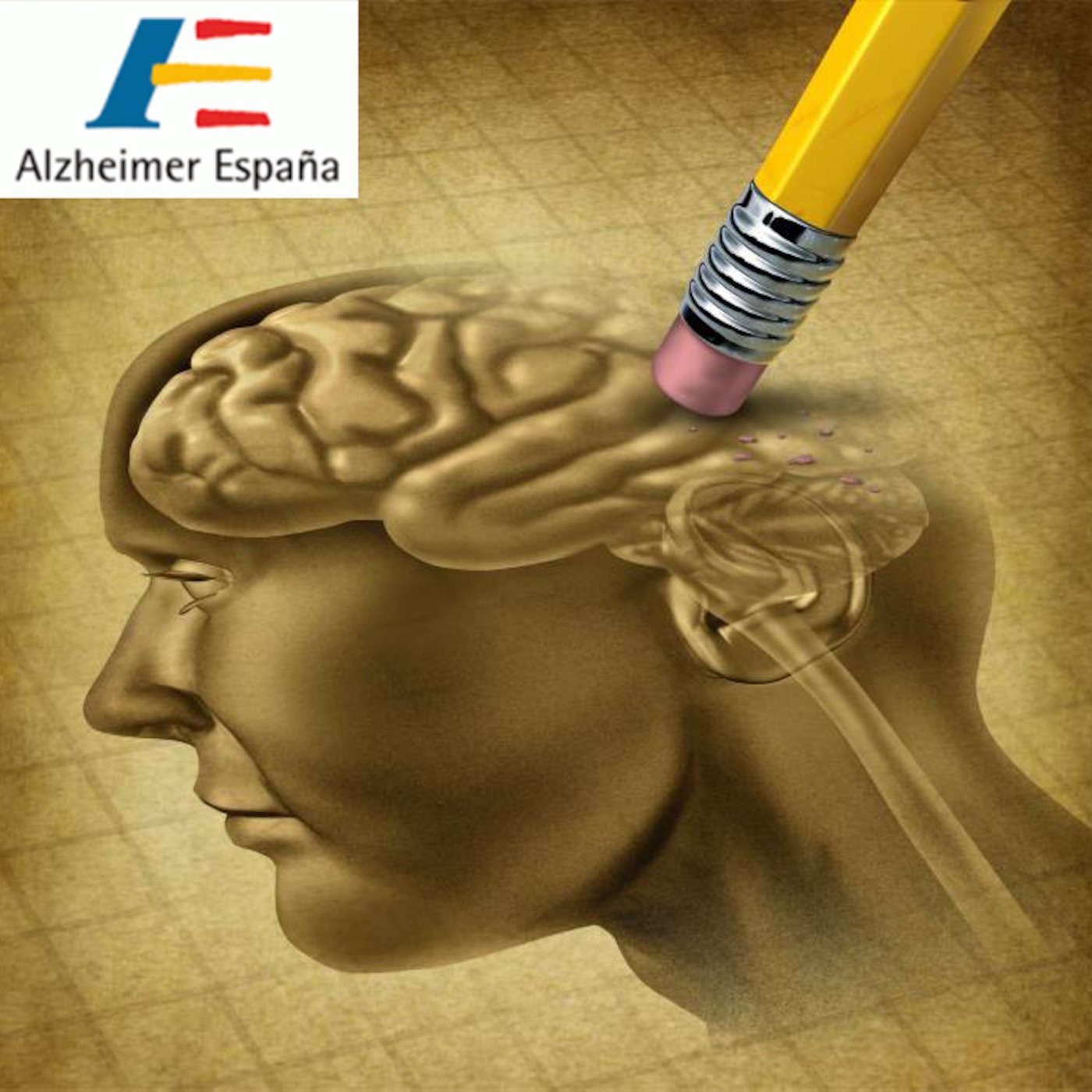 ¿Son los trastornos de la memoria sinónimo de enfermedad de Alzheimer? - Preguntas al neurólogo episode artwork