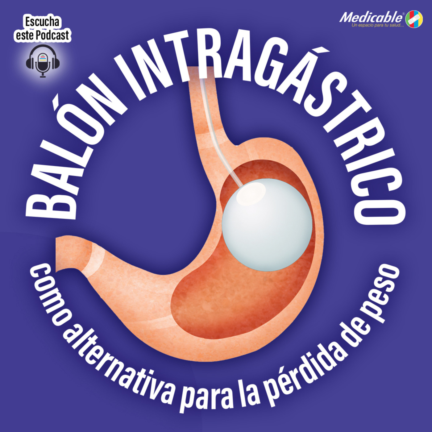 Balón intragástrico como alternativa para la pérdida de peso. episode artwork