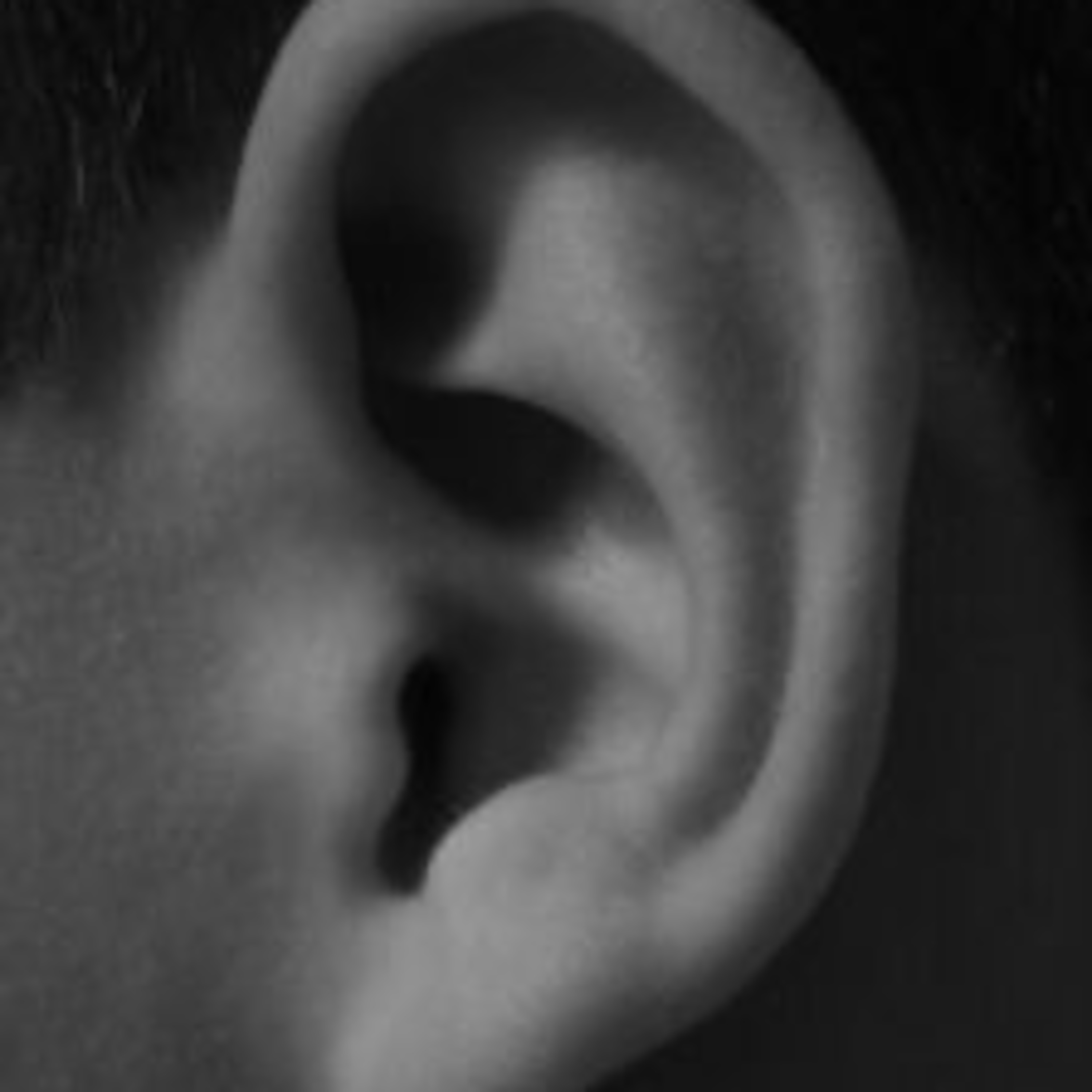 The Art of Listening, for Customer Experience Improvement episode artwork