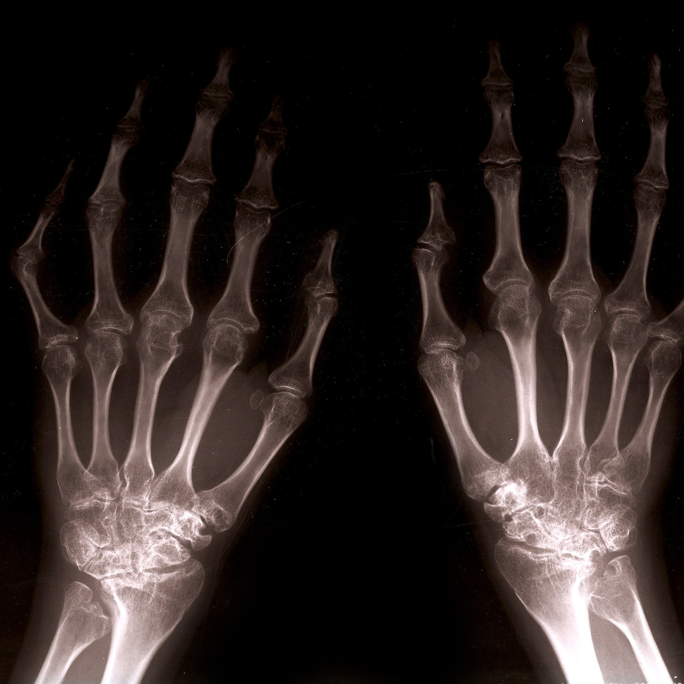 Episode 339: X-Ray
