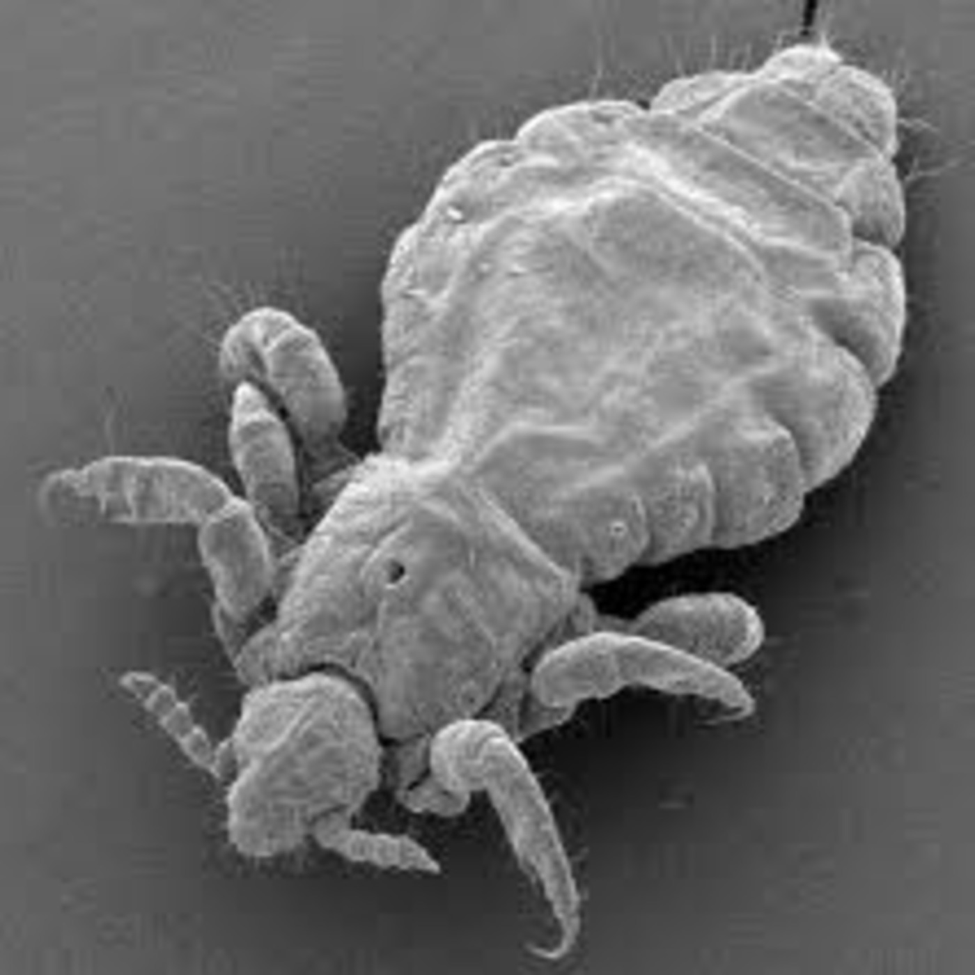 La could have Spent the $575 million on Teachers Roni Deutch IRS lady in Trouble Bed Bugs