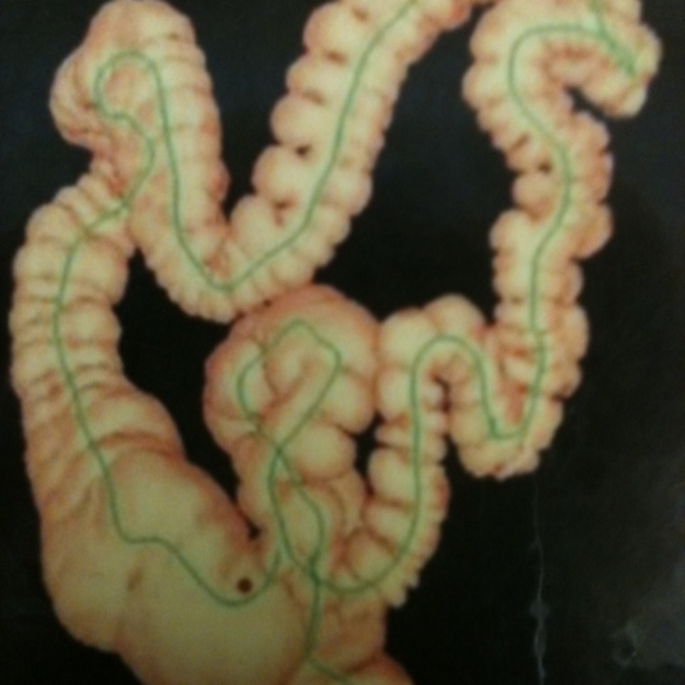 Part 2 - 3 Best Things for Proactive Health: Colonoscopies episode artwork