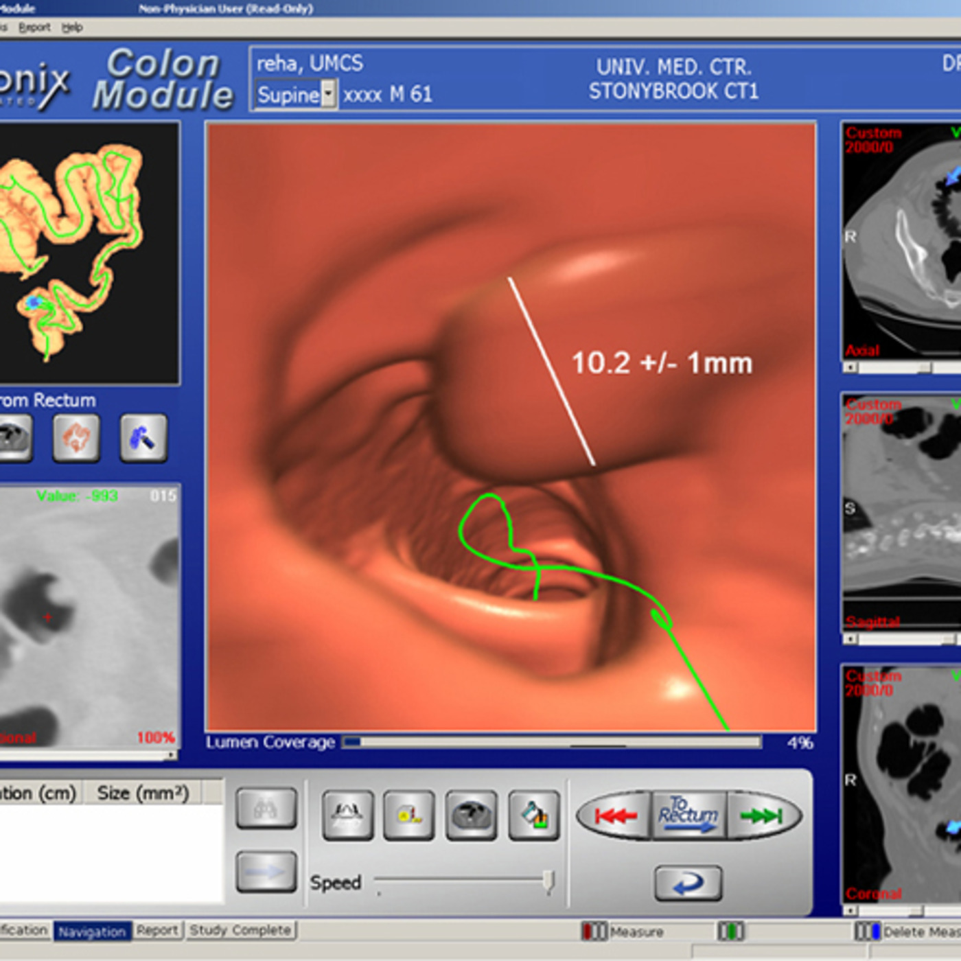 Major Medical Misconception #4 - Conventional Colonoscopies Are Better Than Virtual Colonoscopies episode artwork