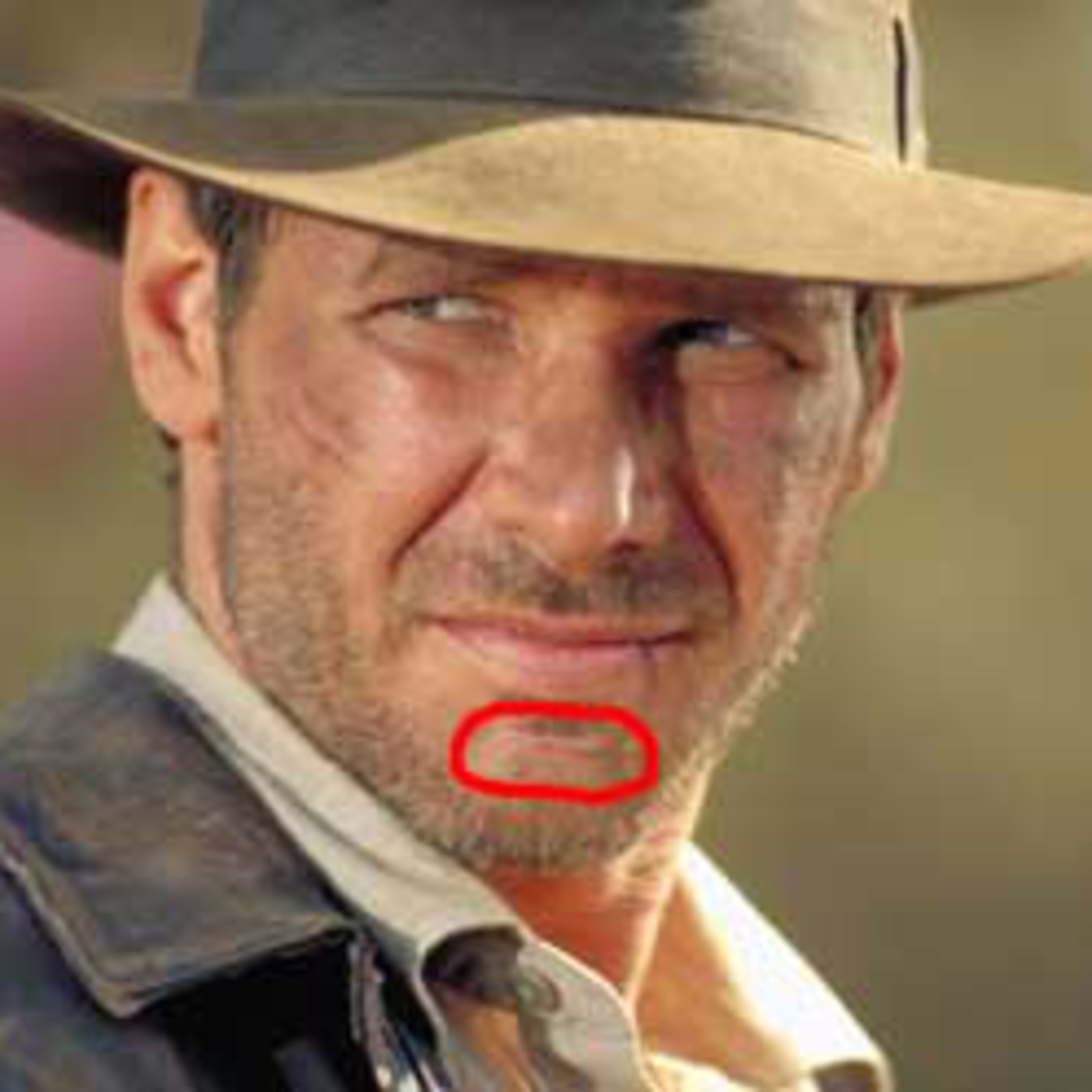 Episode 5 - CHIN SCAR pt 2