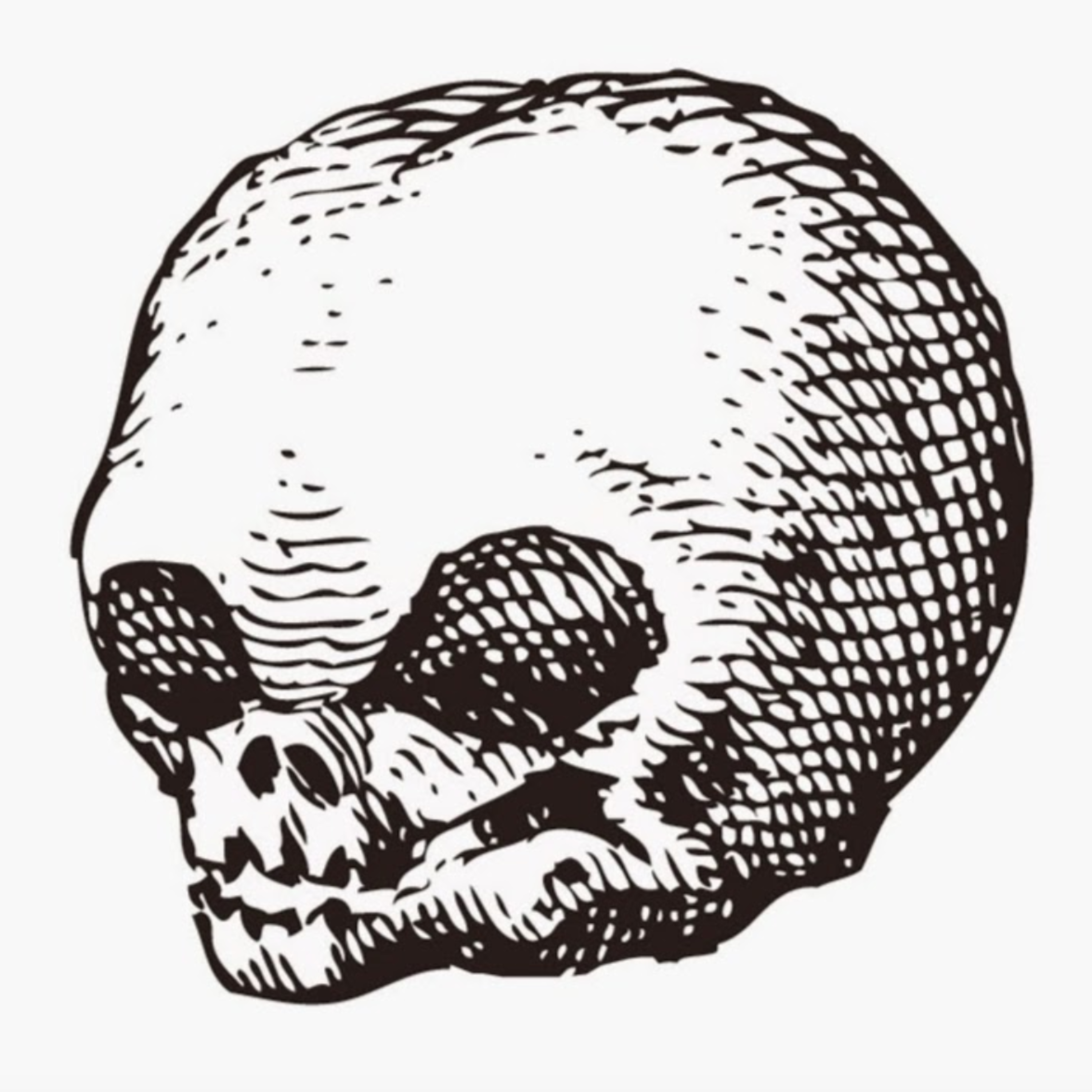 The Morbid Anatomy Transmission