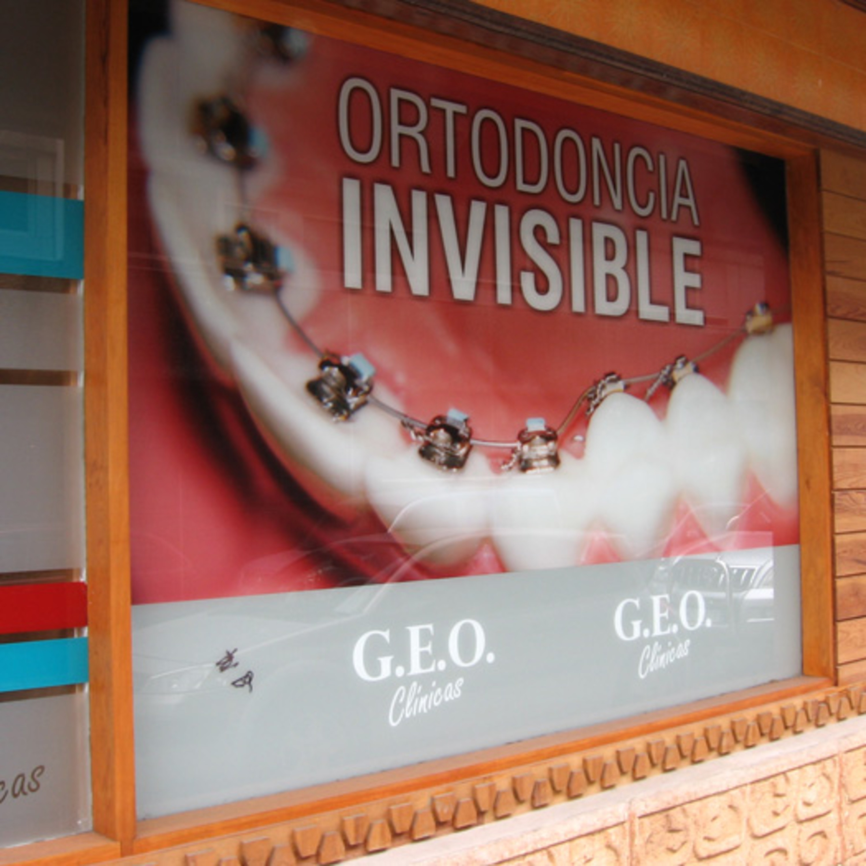 implantes dentales en las palmas episode artwork