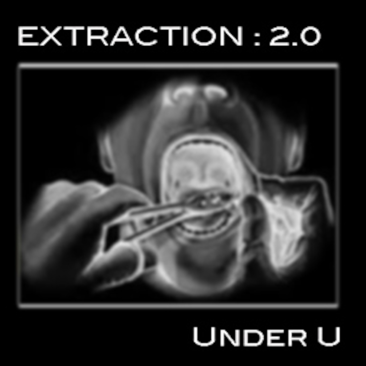 UNDER U EXTRACTION 2.0